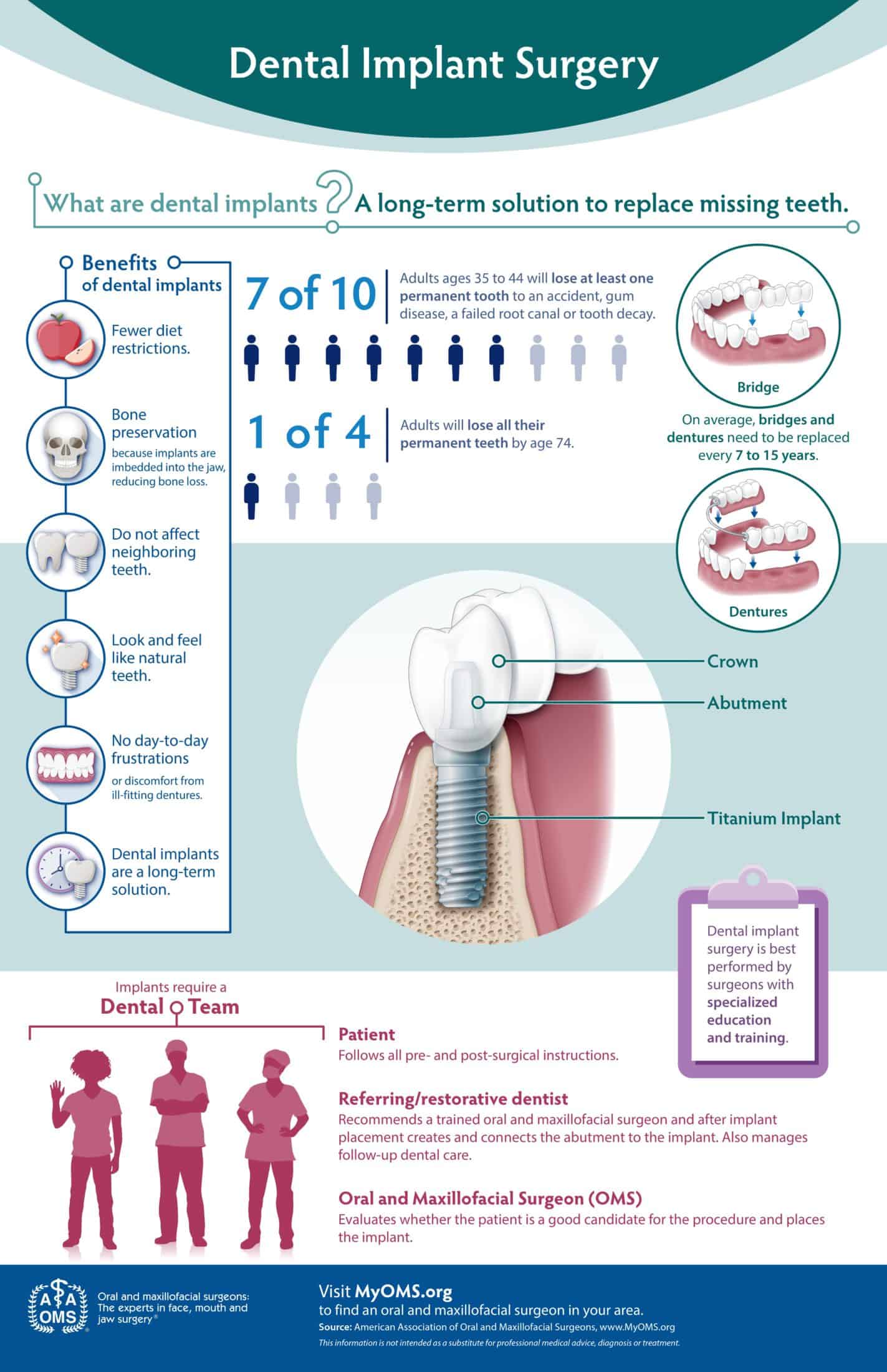 dental implant infographic